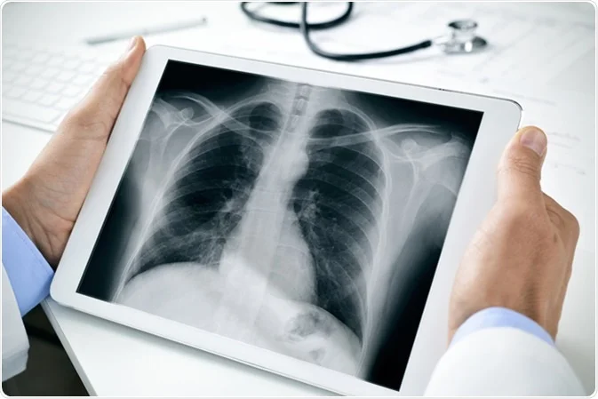 radiologia_digitale Pneumologo a domicilio Roma, scopri il servizio di ADI Salus