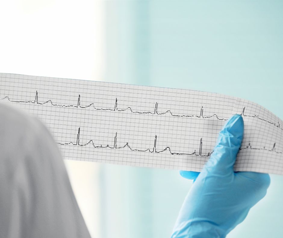 elettrocardiogramma a domicilio roma Elettrocardiogramma a domicilio con il servizio di cardiologo domiciliare di ADI Salus
