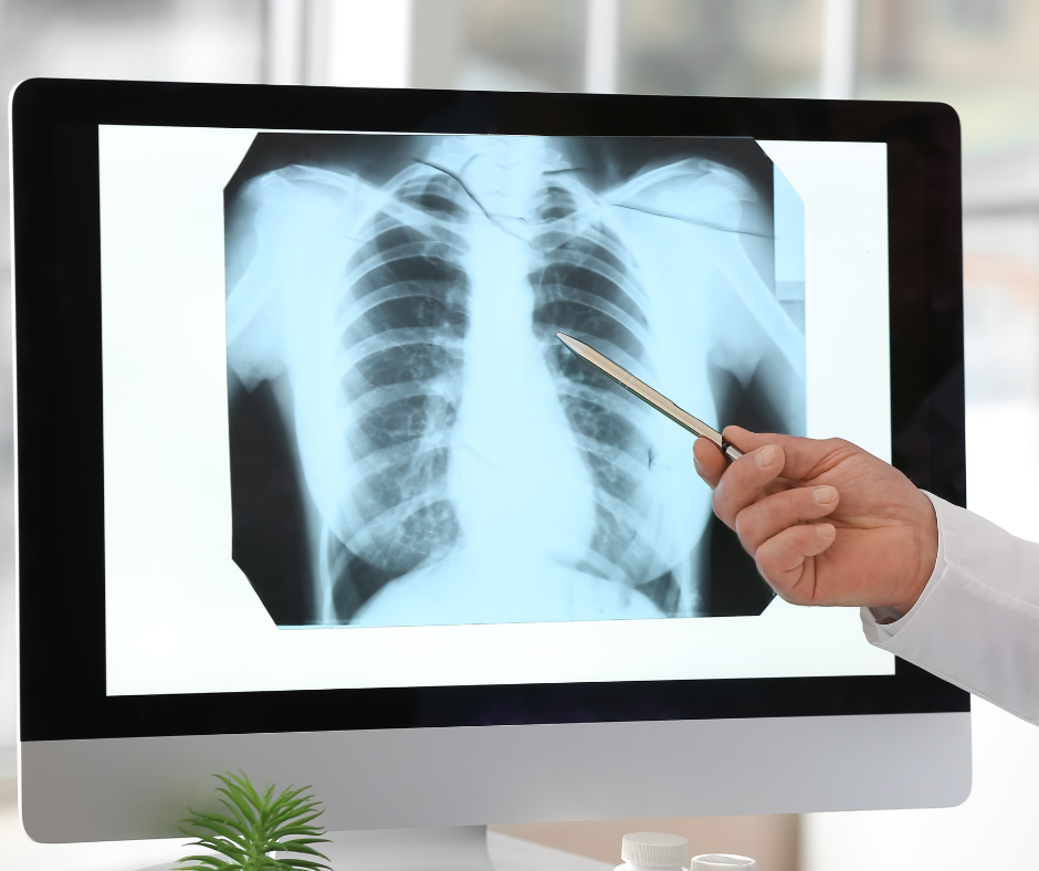 pneumologo a domicilio roma Scopri il servizio di Pneumologo a Domicilio a Roma, proposto dal team di ADI Salus