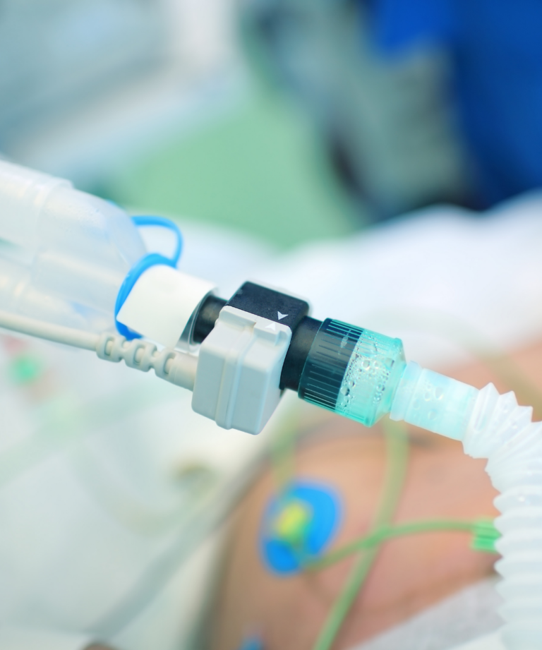 Qualità della vita di un paziente con ventilazione prolungata a domicilio